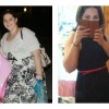 Left: Pre-surgery Right: 4 months post surgery.
